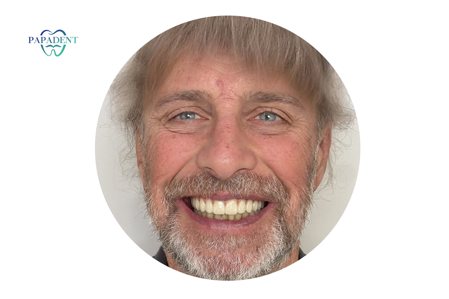 Dainiaus sėkmės istorija su All on 4